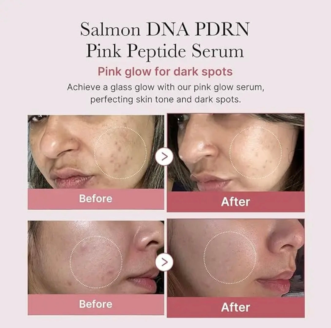 Medicube Salmon DNA Pdrn Pink Peptide Serum 30ml 1.01 fl. oz.